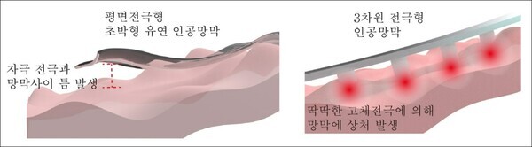 기존 고체 금속 기반의 평면 전극형/3차원 전극형 인공망막의 한계. 사진=세브란스 안과병원