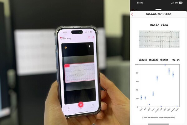 ‘ECG Buddy’ 구동 예시, 스마트폰으로 심전도 이미지를 촬영(좌측)하면 분석 결과를 출력(우측)한다.  사진=분당서울대병원